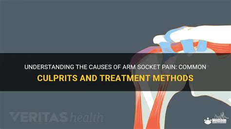 Understanding The Causes Of Arm Socket Pain: Common Culprits And Treatment Methods | MedShun