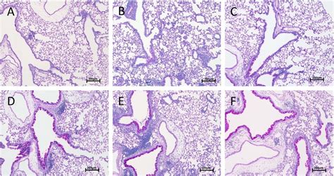 PAS stained histological lung sections demonstrating scoring for mucous... | Download Scientific ...