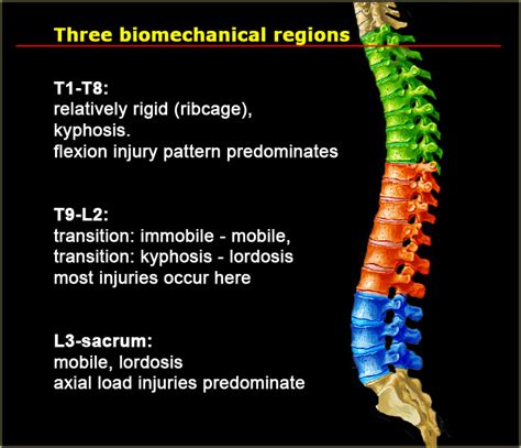 The Radiology Assistant : Spine ... | Soft tissue injury, Radiology, Bone injuries