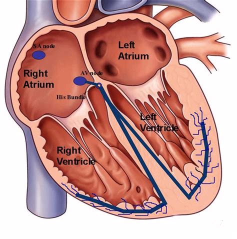 Treatment for Atrioventricular (AV) Block in Washington DC & Maryland