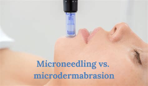 Microneedling vs Microdermabrasion | Vujevich Dermatology Associates