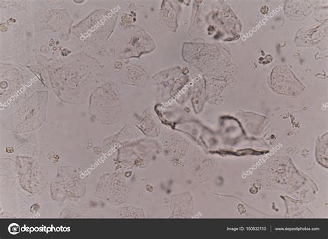 celulas epiteliais na urina