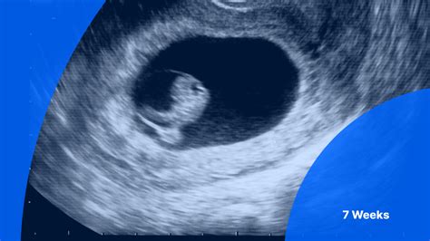 dating scan 7 weeks heartbeat