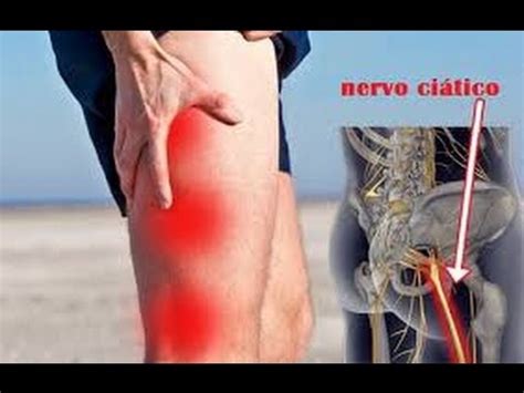 dor ciática perna direita