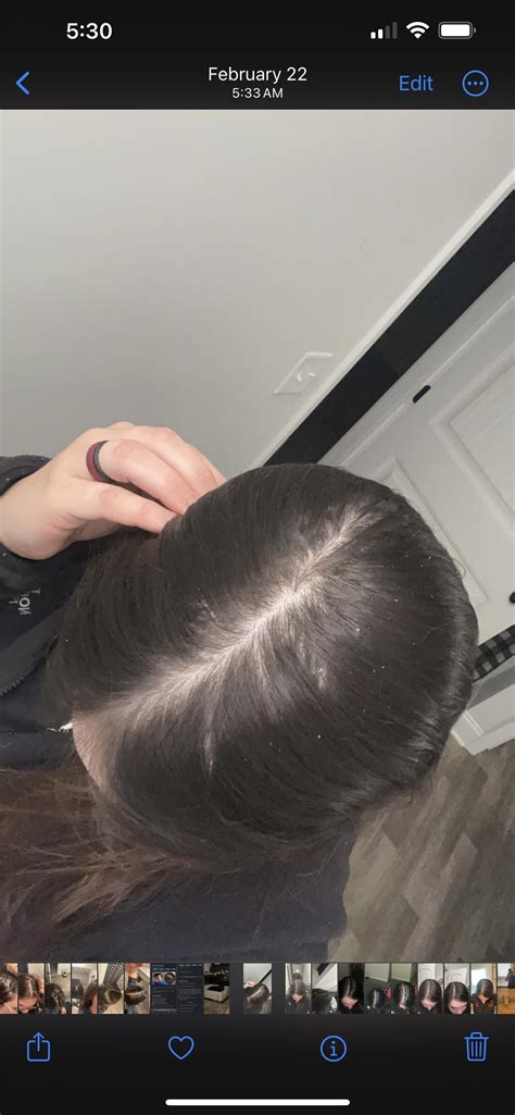 reddit hair loss dating
