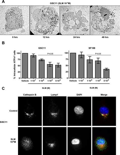 GSC11   GSC11 Cells Were Treated With Niclosamide And Tmz - GSC11