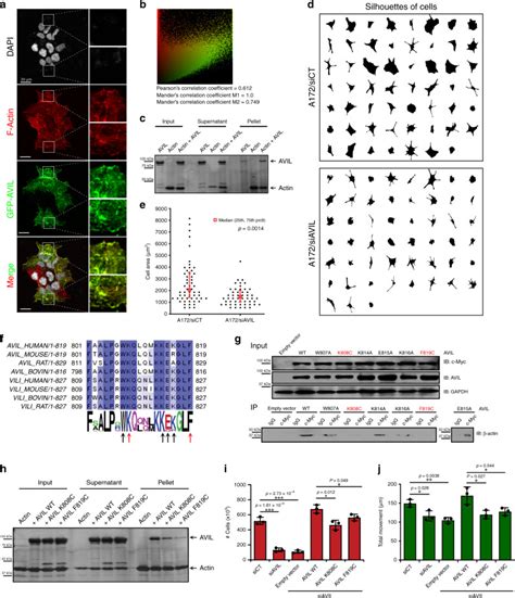 A Cytoskeleton Regulator Avil Drives Tumorigenesis In Glioblastoma GSC11 - GSC11