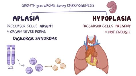 Aplasia Definition Types Amp Causes Cleveland Clinic Agenesia - Agenesia