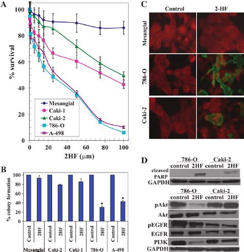 Enhanced Anticancer Effect Of Lysozyme Functionalized Metformin Loaded Loaded - Loaded