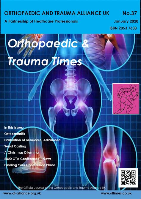 Orthopedic Archives Dr Trish Com Bukabet Alternatif - Bukabet Alternatif
