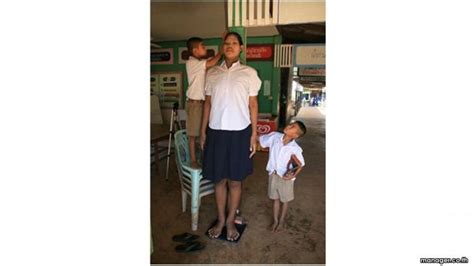 Thailand X27 S Tallest Woman Died At 24 Duangdee - Duangdee