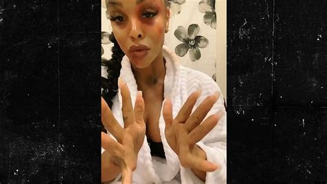 Preview 3 of Masika Kalysha Onlyfans Download Leaks