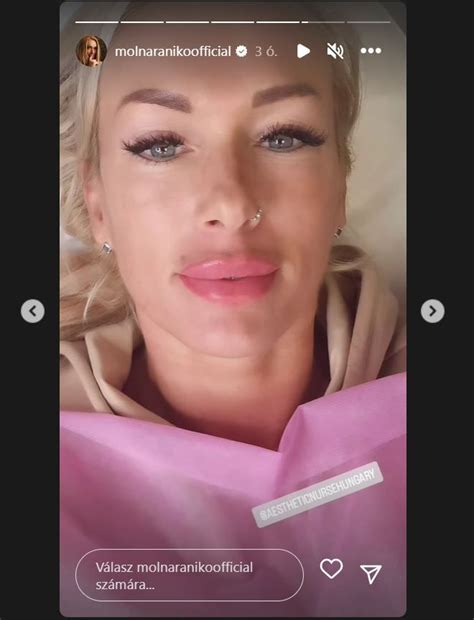 Preview 4 of Molnar Aniko Nude Telegram Leaks Vault