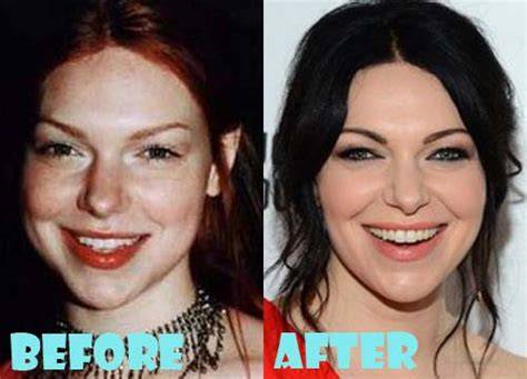 Laura prepon plastic surgery OnlyFans channel