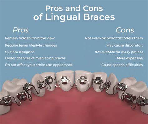 Lingual braces rsm OnlyFans channel