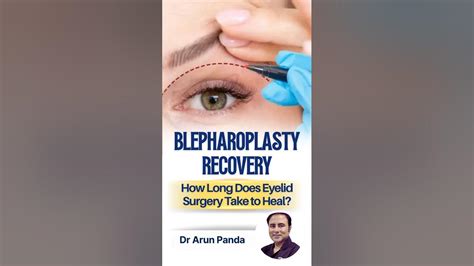 Blepharoplasty Recovery | Eyelid Surgery Healing Timeline #Shorts - YouTube