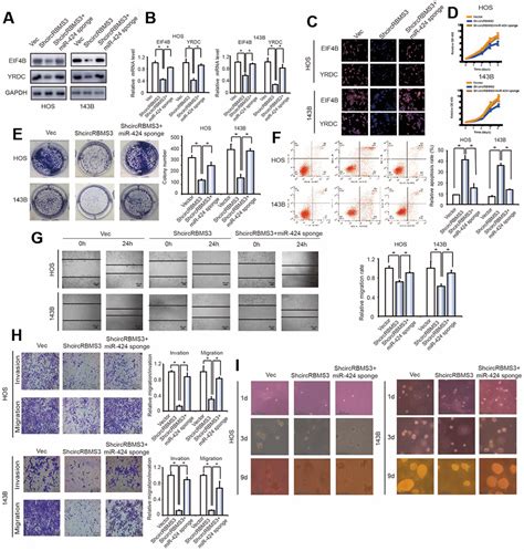 A Novel Circular Rna Circrbms Regulates Proliferation And Metastasis