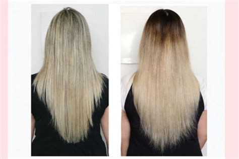 Biotina Cabelo Antes E Depois - Biotina no cabelo: Antes e depois para conhecer seus Efeitos
