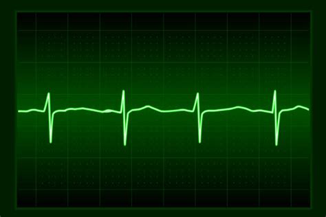 Sine Wave Ecg Illustrations, Royalty-Free Vector Graphics & Clip Art ...