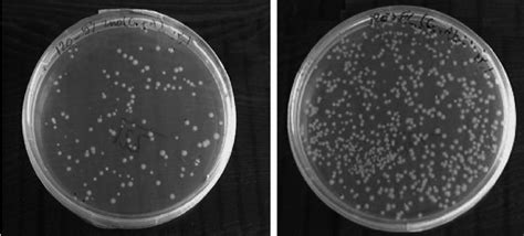 Images Of Bacteriological Tests Of E Coli On Solid Agar Plates With