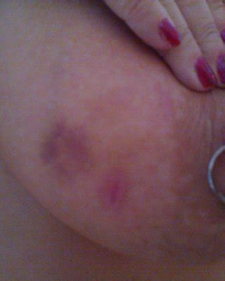 Scottish Tits Porn Pics Pictoa