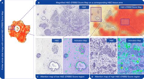 Hande Erbb2 Score And Grad Cam Activation Maps A Hande Erbb2 Score Map