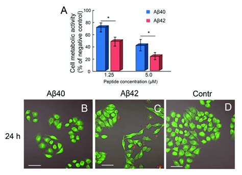 Effects Of Amyloid Fibrils Formed From Aβ40 And Aβ42 On Hela Cells The