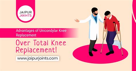 Unlocking the Benefits: Advantages of Unicondylar Knee Replacement Over