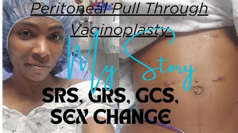 Mtf The Truth About My Trans Surgery Srs Grs Gas Gsc Sex Change Bottom Surgery Youtube
