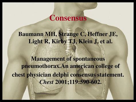 Ppt Traitement Chirurgical Du Pneumothorax Spontan Powerpoint