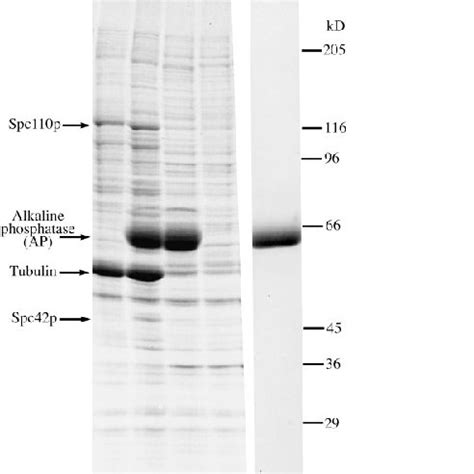 identification  proteins  coomassie stained sds gel bands