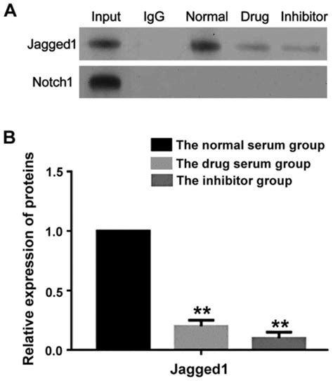 The Role Of Jagged1 Notch Pathway‑mediated Angiogenesis Of Hepatocarcinoma Cells In Vitro And