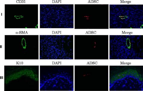 Expression Of Epithelial Cell Markers Cd31 α Sma K10 In Wound Skin