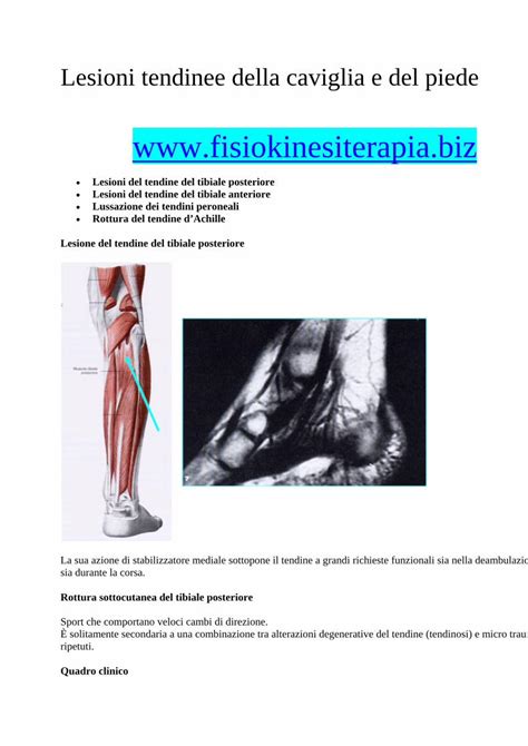 PDF Lesioni Tendinee Della Caviglia E Del Piede Lesioni Tendinee