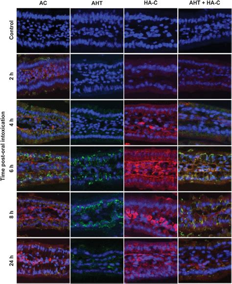 Immunofluorescence Tracking Of The Bont A Complex Bont A Holotoxin And