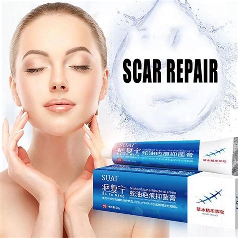 Scar Repair Cream Acne Remove Gel Fade Stretch Marks Acnes Spots Burn