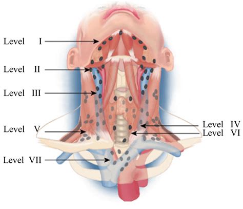 38+ Lymph Nodes Diagram Neck - SekarMarlina