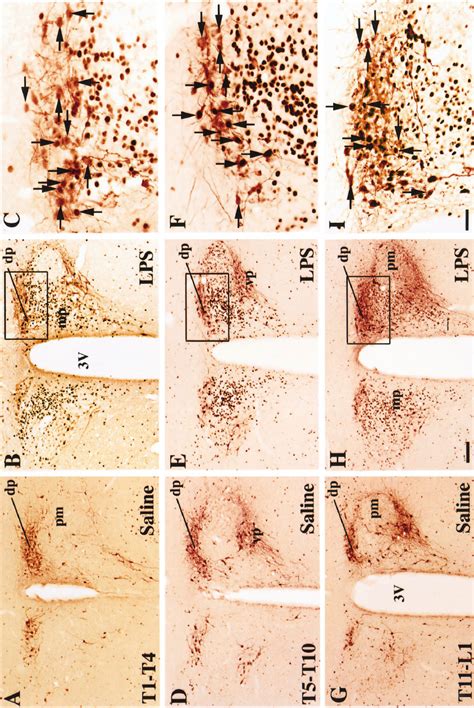 A Series Of Photomicrographs Demonstrating The Distribution Of Fos Ir