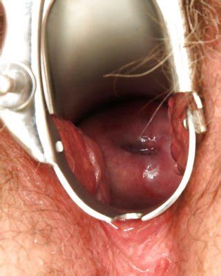 Short Haired Mature Blonde With Ample Ass Get Her Pussy Examed By Gyno Porn Pictures Xxx Photos