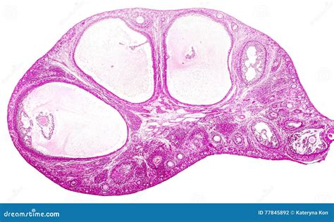 Light Micrograph Of Ovary Stock Photo Image Of Secondary 77845892