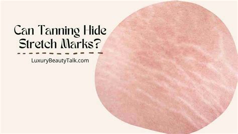 Can Tanning Hide Stretch Marks Tips And Guides Womens Beauty Skin