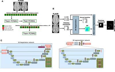 Frontiers Improving The Detection Of New Lesions In Multiple