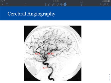 Exam Neuro Assessment And Diagnostics Flashcards Quizlet