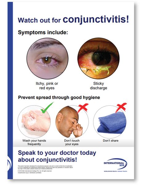 Health Information Conjunctivitis