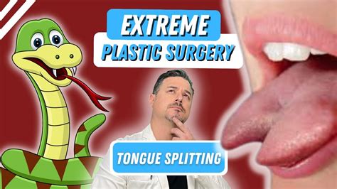 Forked Tongue Surgery Youtube