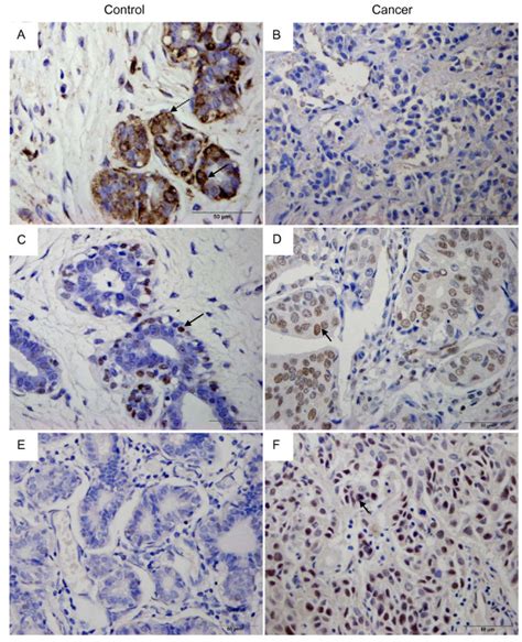 Representative Photomicrographs Immunohistochemical Expressions For Download Scientific