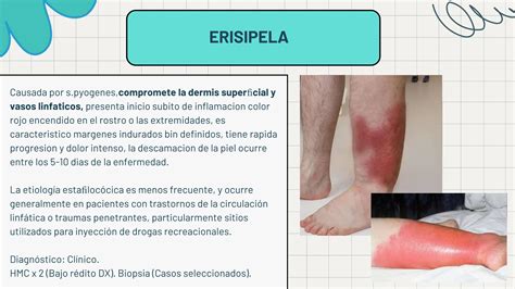 Infecciones De Piel Y Partes Blandas Pptx