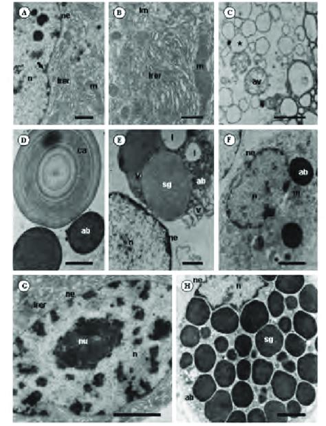 Transmission Electron Micrographs TEM Of Semi Engorged Females