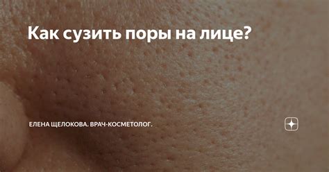 Как сузить поры на лице? | Face Clinic | Клиника косметологии в Москве ...