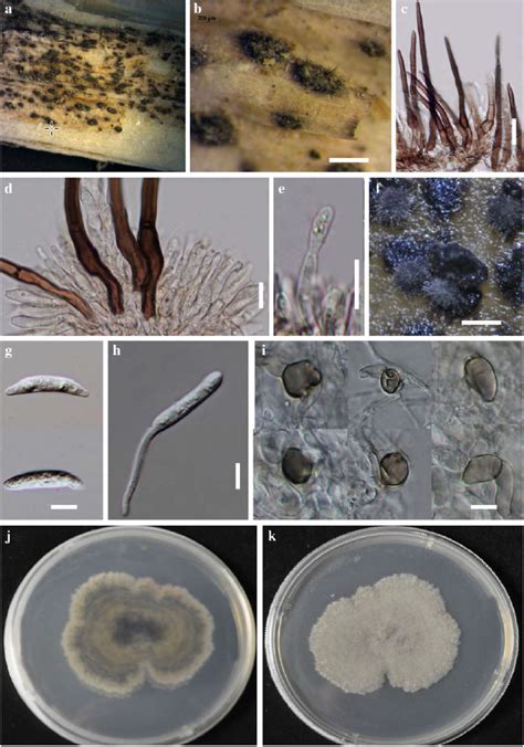 Colletotrichum Sedi Facesoffungi Number FoF 00332 Faces Of Fungi